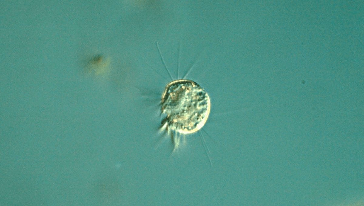 virovoreHalteria | The Phage virovore Halteria the virus eating protist