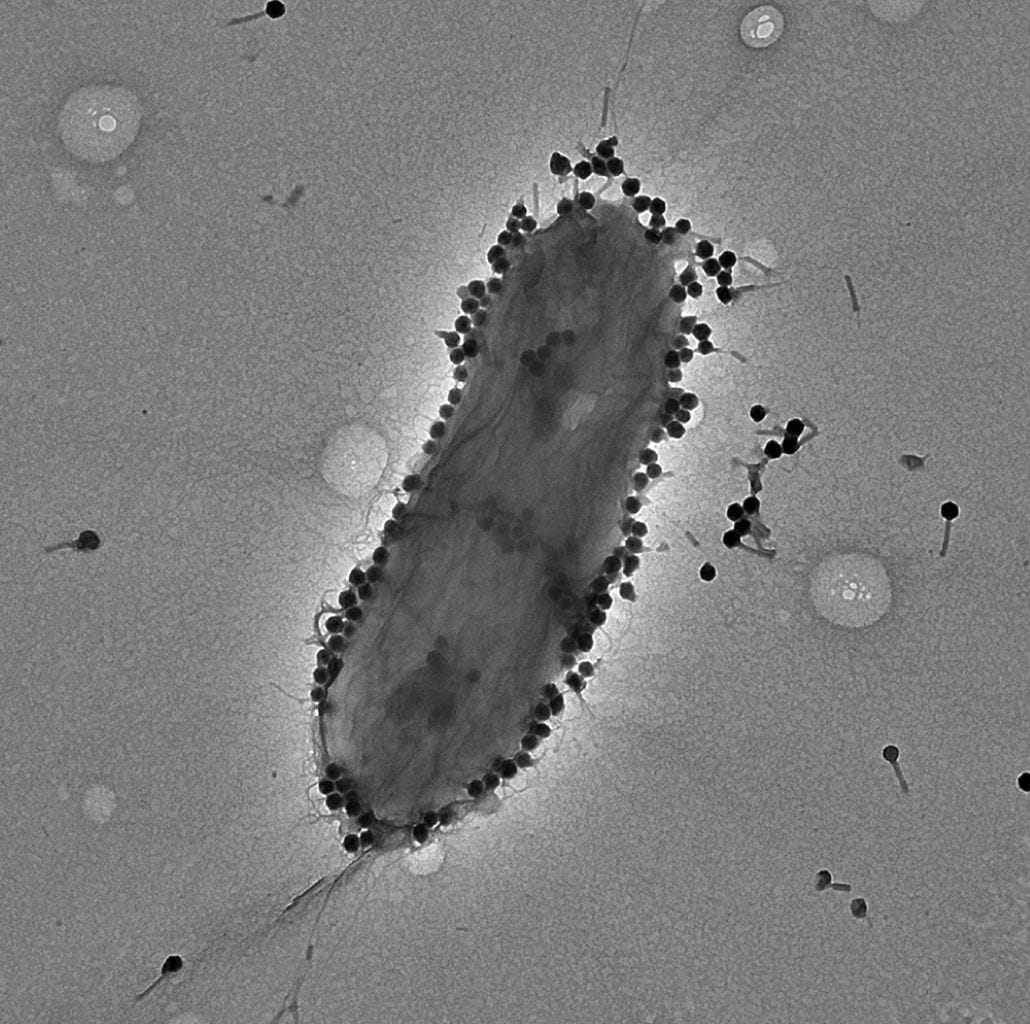 A TEM visualization of the phage PASA16 with P aeruginosa PA14 | The Phage A TEM visualization of the phage PASA16 with P aeruginosa PA14