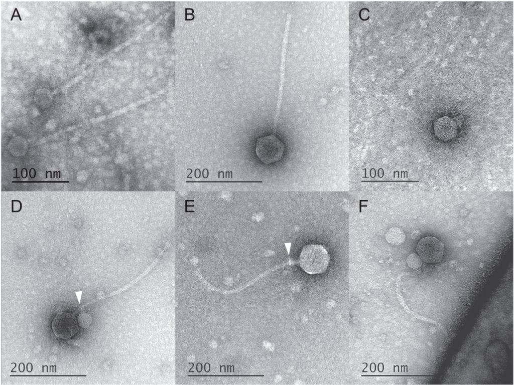 image1 | The Phage The original study's TEM images showcasing First-ever observation of a virus attaching to another virus
