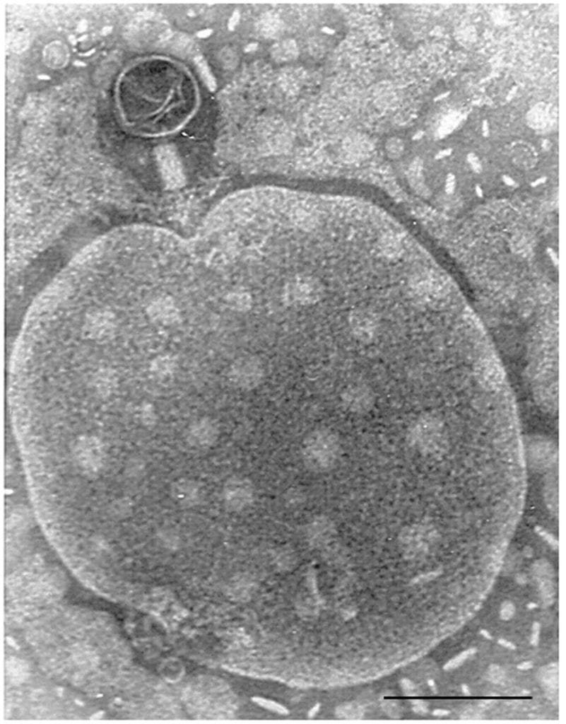 bacteriophage and human cell | The Phage electron Microscopy of bacteriophage near the human cell