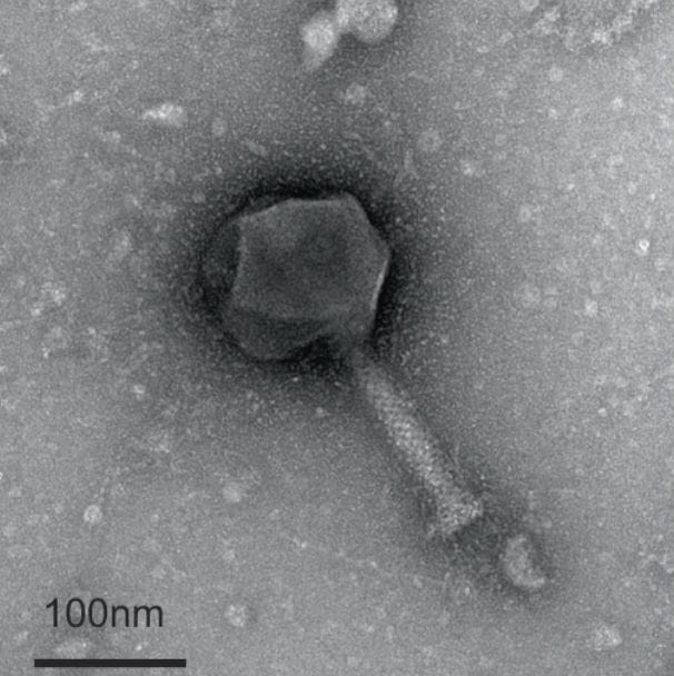 Screenshot20240120at153049 | The Phage Negative stain TEM micrograph of phage Paride