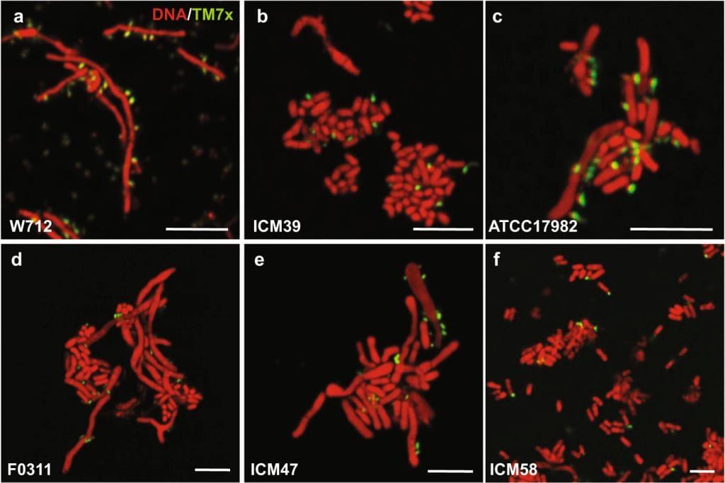image2 | The Phage Photo of Nanosynbacter lyticus aka TM7x green and bacterial hosts red