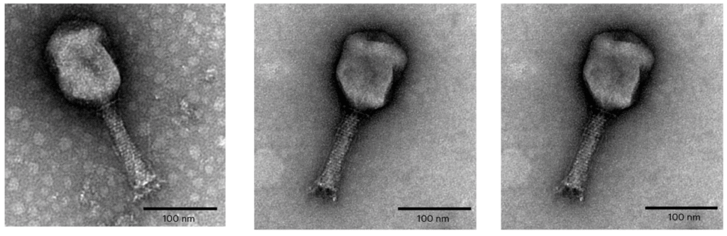 TEM images of the three phages | The Phage Transmission electron microscopy TEM images of the three phages used in the study to design of a hospital specific phage cocktail to treat Enterobacter cloacae complex infections